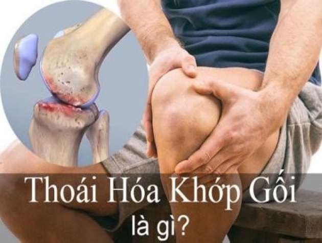 Thực phẩm bảo vệ sức khỏe Hoàng Thấp Linh giải pháp tuyệt vời cho người bị thoái hóa khớp gối